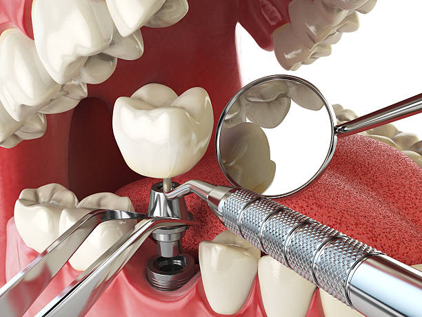Best Emergency Tooth Extraction  in Holtville, CA